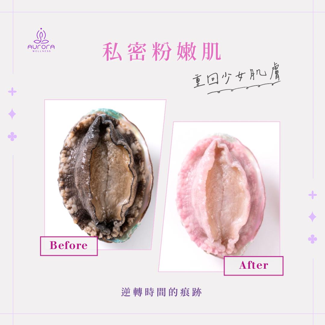 專業私密美白護理