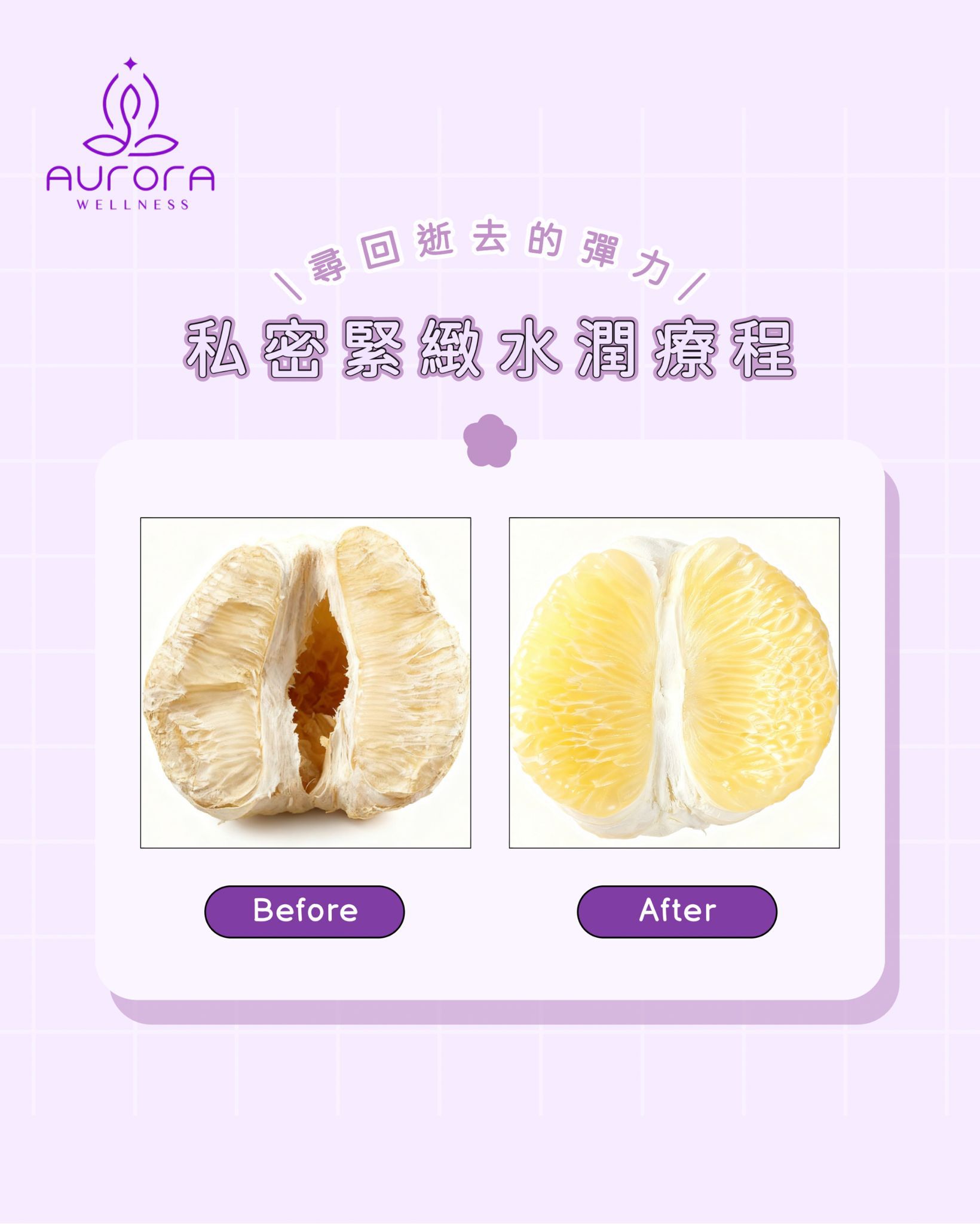 專業產後私密護理